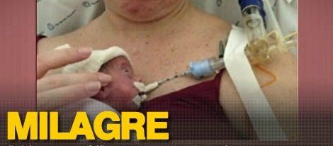 Conheça Beatriz, uma guerreira nascida na Pro Matre