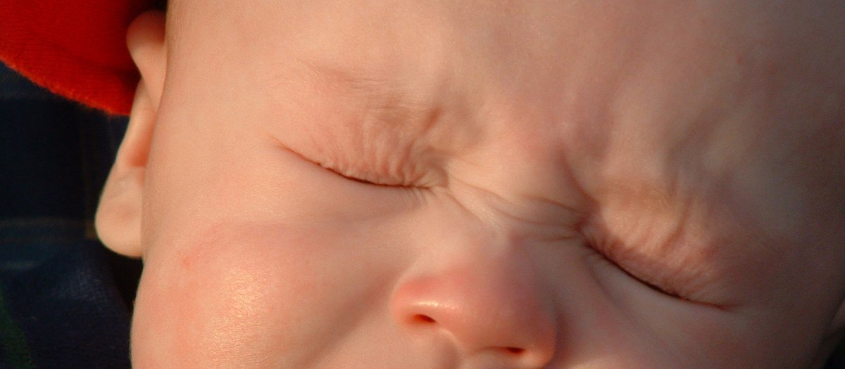 No outono, aumentam os casos de alergia entre bebês: mito ou verdade?